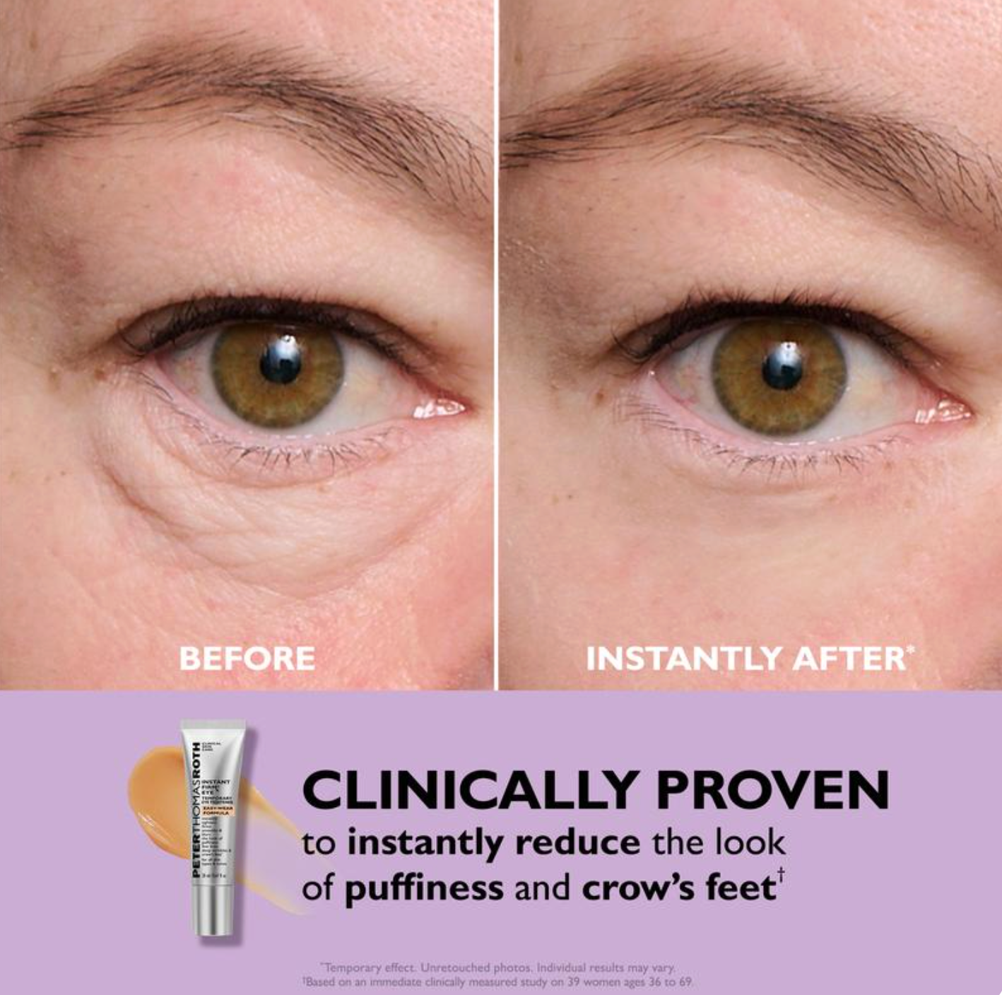 Instant FirmX Eye Cream - Smooths Lines, Reduces Puffiness & Dark Circles