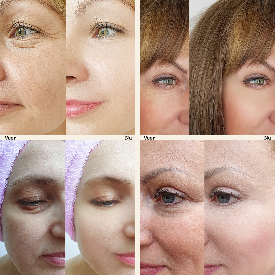 Instant FirmX Eye Cream - Smooths Lines, Reduces Puffiness & Dark Circles