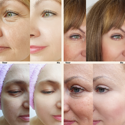 Instant FirmX Eye Cream - Smooths Lines, Reduces Puffiness & Dark Circles